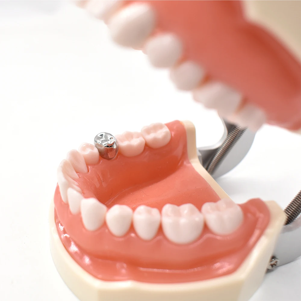 Dental Temporary Crowns 5pcs/bag Stainless Steel Pedo Molar Crown Refill Kit 1st 2nd Preformed Kids Primary Orthodontic Material