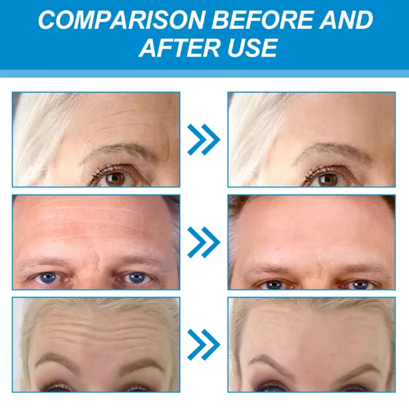 5 قطعة/المجموعة هيدروجيل بقع فيلم المضادة للتجاعيد إزالة الهالات السوداء تغذي قناع ترطيب رفع ثبات الجلد عيون الجبين الرعاية