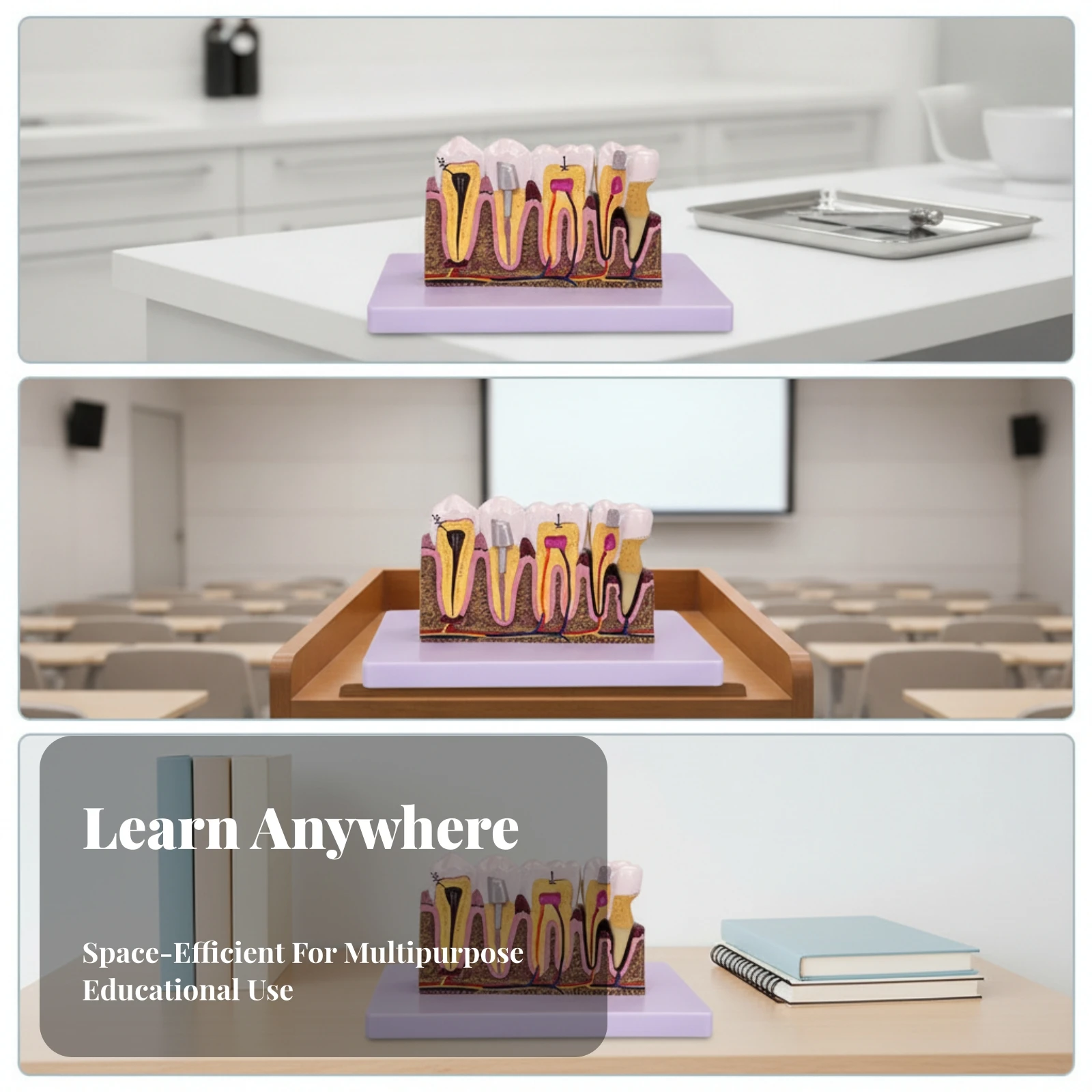 PVC Dental Pathology Model with Base Color-Coded Dental Caries Teaching Model 3D Visual Lifelike Colors for Classrooms