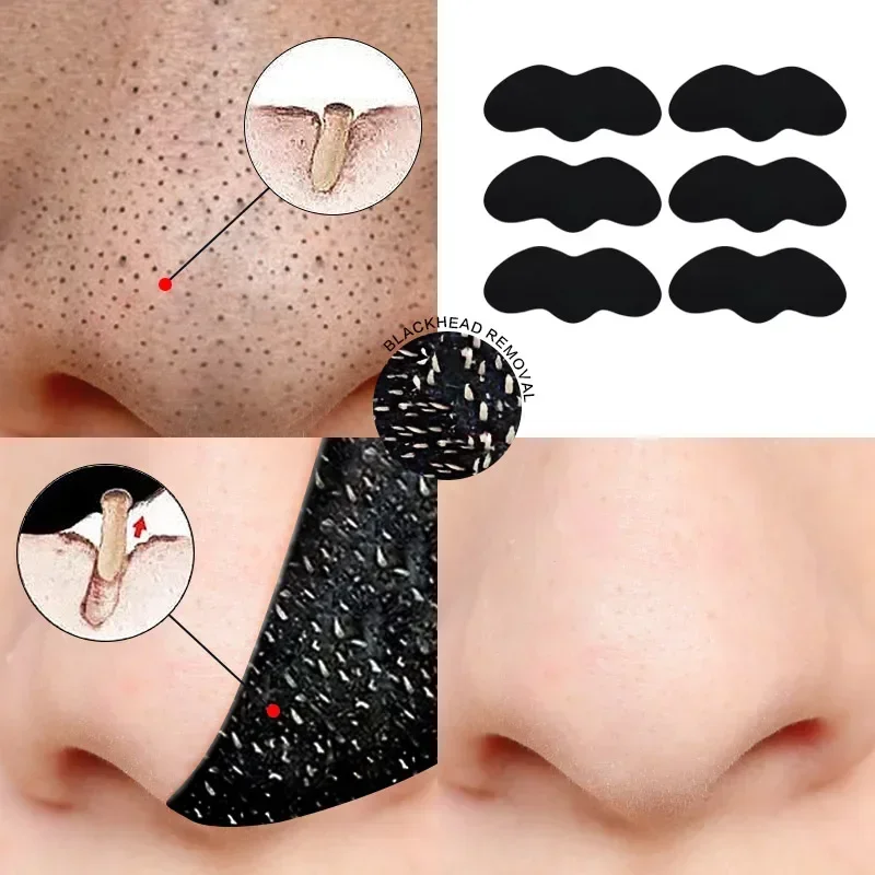 10PCS จมูก Blackhead Remover หน้ากากหดรูขุมขนสิวสติกเกอร์จุดสีดําแถบจมูกลึกทําความสะอาด Skin Care