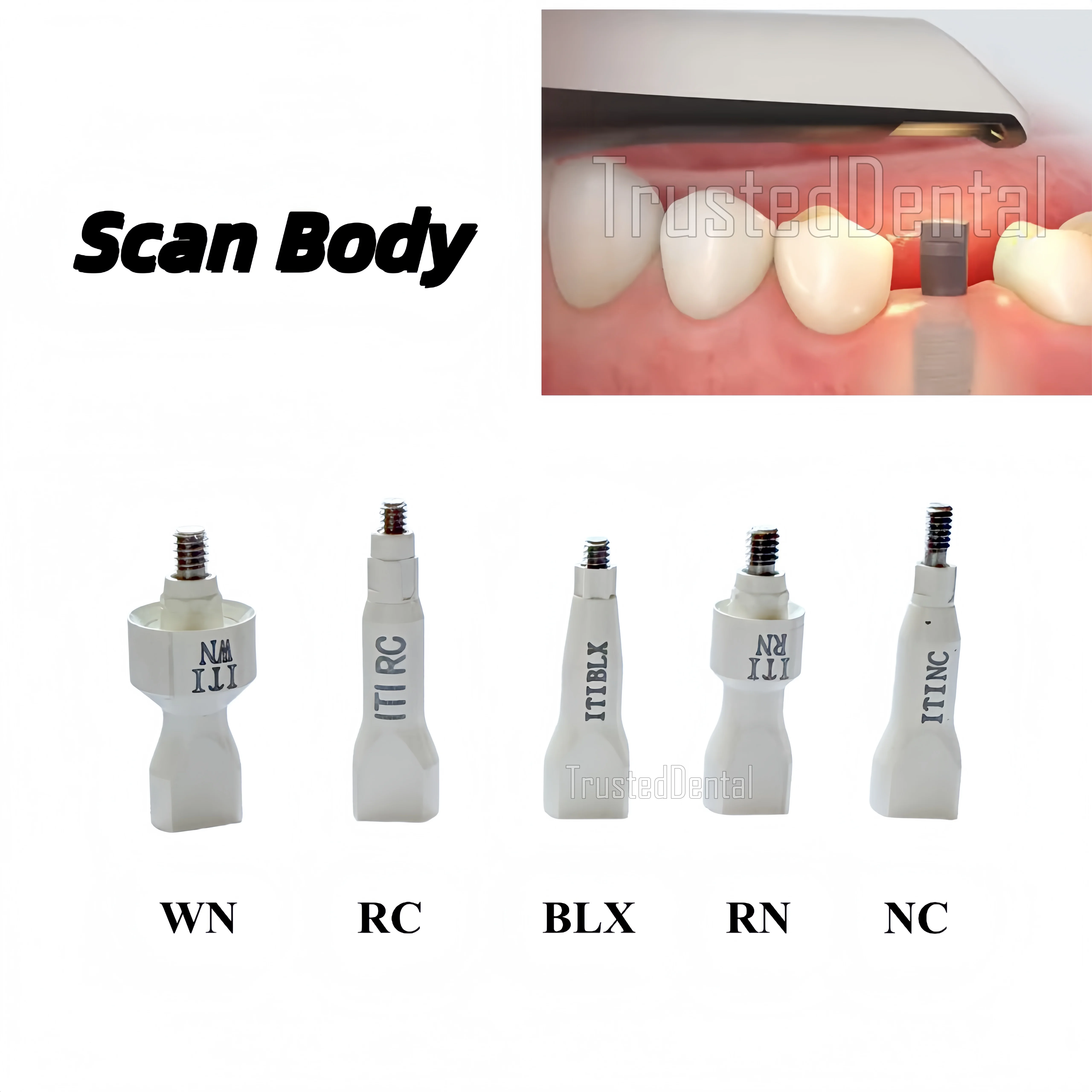 Сканеры Scan Body CAM CAD, совместимые с ITI Straumann Scanbodies, 3shape Dental Wings Scanner, инструменты для стоматологии Exocad