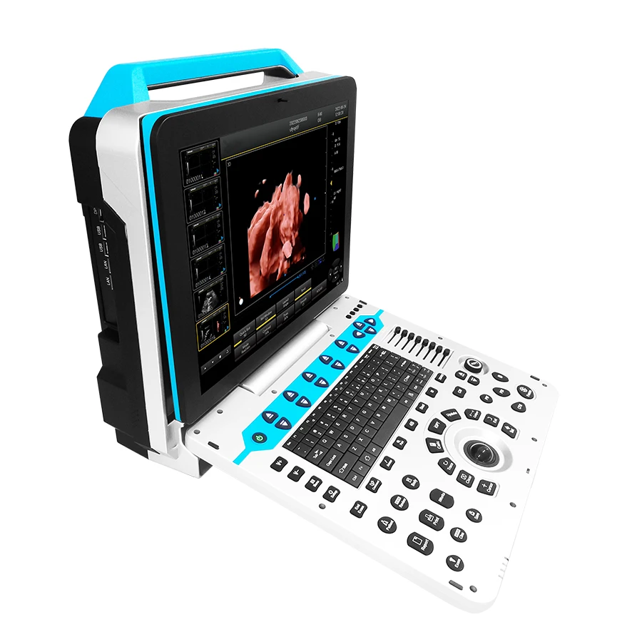 High Quality Medical Equipment 3D/4D Portable Full Digital Color Ultrasound Machine With Optional Probes