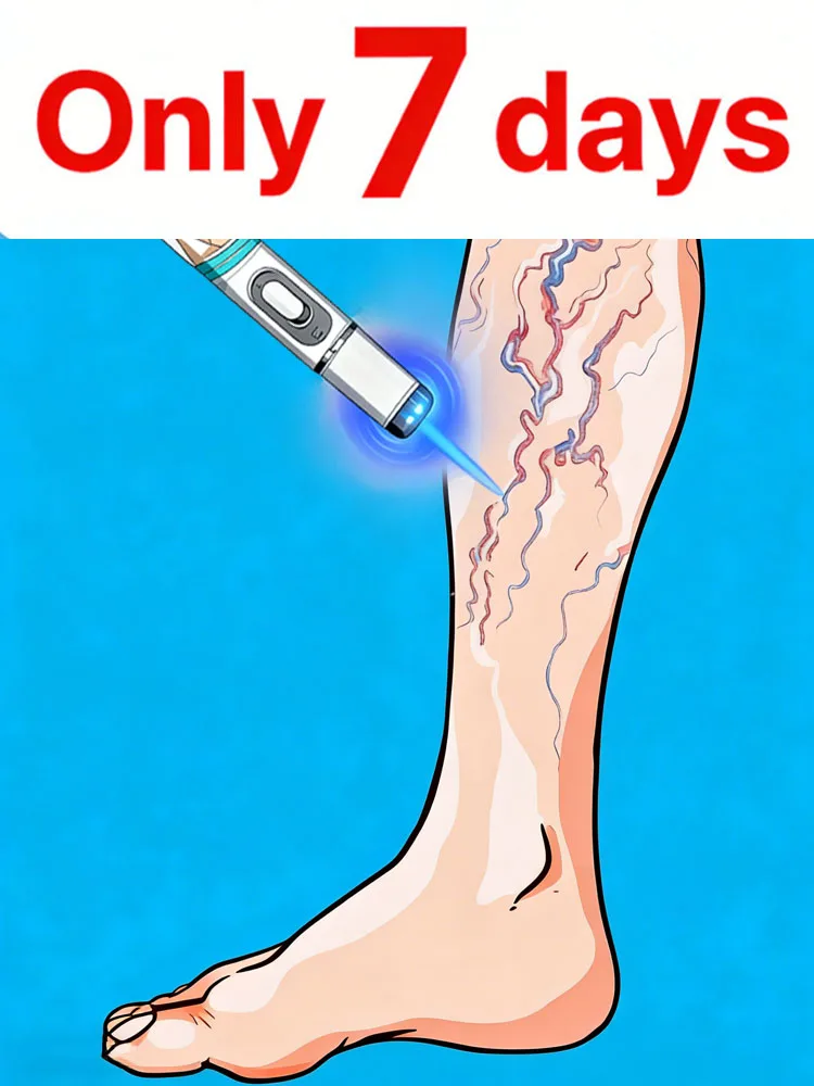 

Ручка с синим светом, используемая для обработки ножек дождевого червя будет модернизированна с прорывом синего светового индикатора в 2023 году.