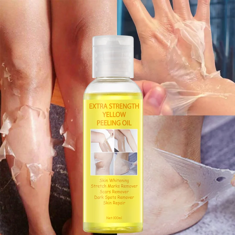 

100ml Yellow Peeling Oil Deep Cleansing and Exfoliating Oil Bleaching Dark Skin Spot Blackheads Blemishes Bad Skin Gel