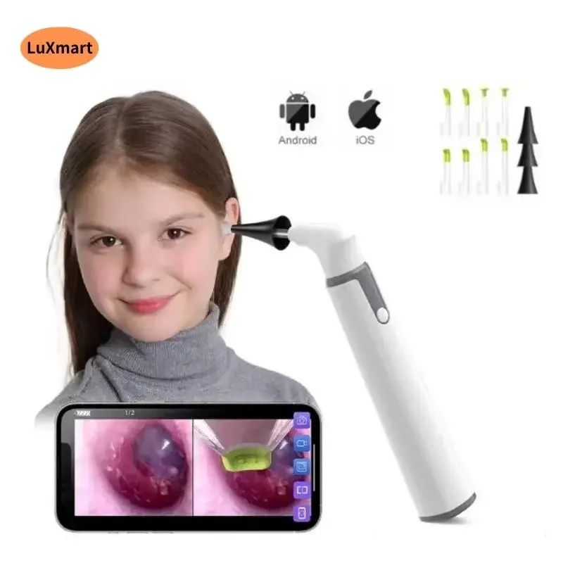 Ear Wax Removal Tool Smart WiFi Visible Light Ear Scoop Home Must 3.9mm 720P for Mobile Android phone