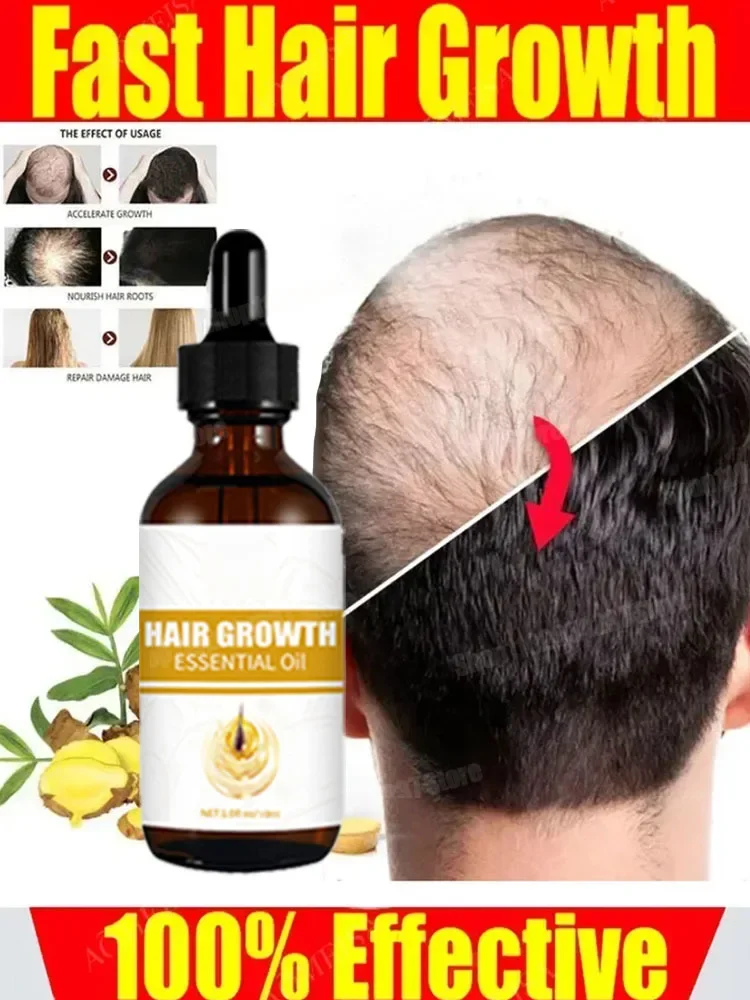 Hair Growth Essential Loss Regrowth Hair Nourishes Scalp Light Weight Non Greasy New