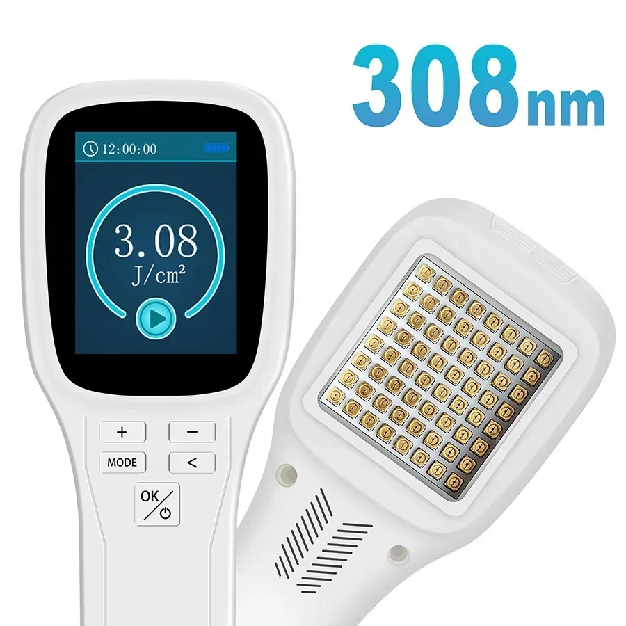 2026//ZJZK professional 308nm excimer   for vitiligo psoriasis treatment no side effects