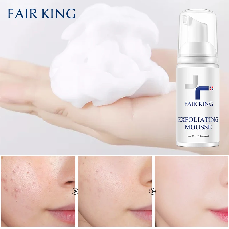 Foaming Exfoliating Mousse Deep Remove Cleaning All Skin Types Wash Face Smooth Moisturizing Skin Exfoliator Unblock Pores 60ML