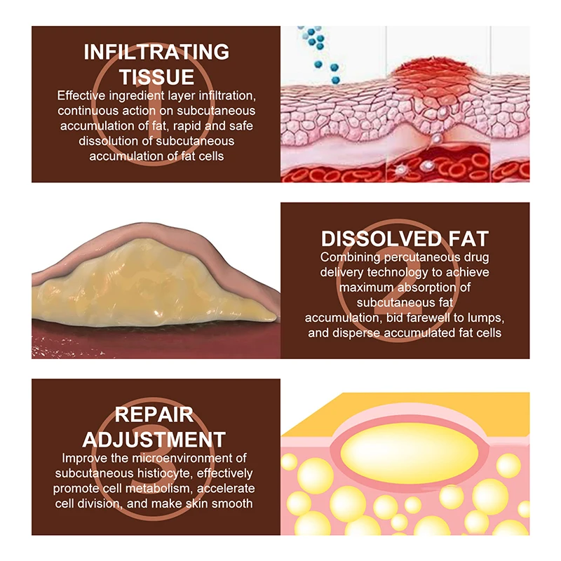 Crème réparatrice de grumeaux sous-cutanés, crème apaisante, soins corporels