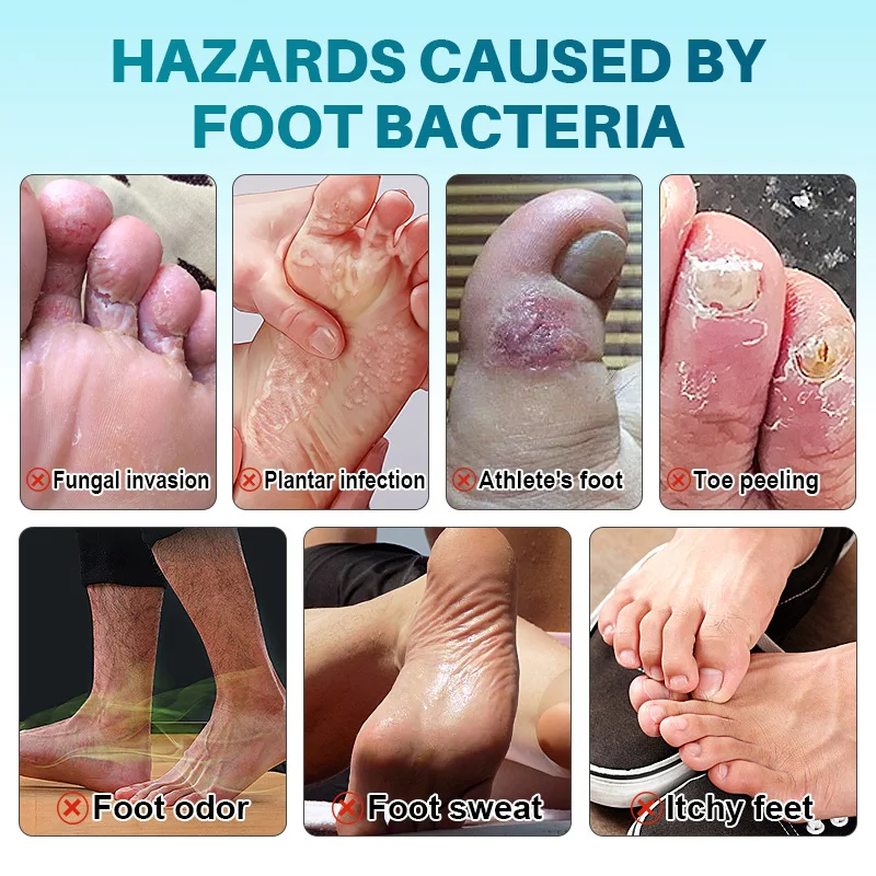 Foot Deodorant Cream Foot Odor Bacteriostasis Antipruritic Athlete's Foot Ointment Skin Topical Cream Personal Health Care