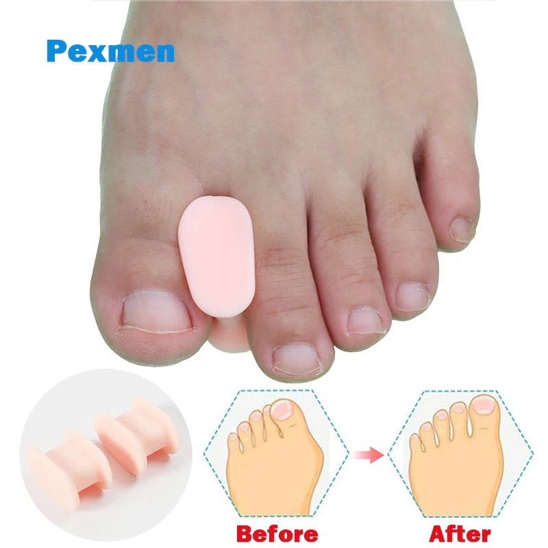 2/4/10 шт., разделители большого пальца ноги