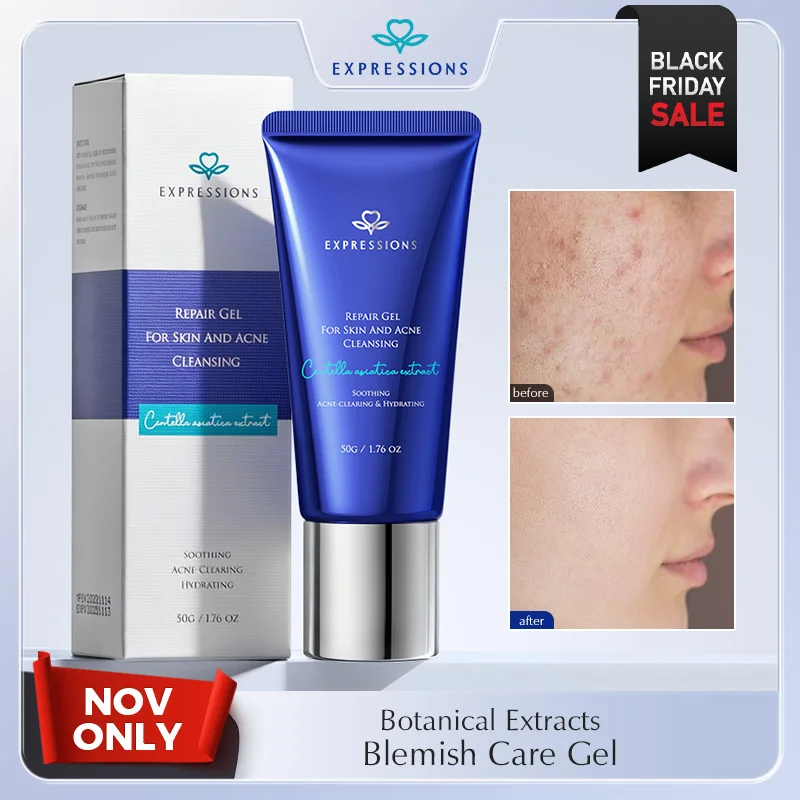 

Acne Treatment Gel for Face - Repair Scar, Blackhead Remover, Oil Control, Moisturizing Whitening Skin Care with Nicotinamide