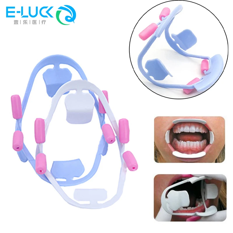 

Стоматологический открывалка для рта 3D ретрактор для губ для полости рта О-образная форма инструменты для ортодонтии стоматология кляп для рта ретрактор для губ стоматологические инструменты