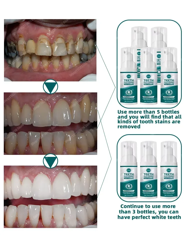 Resolva toEducational, namibiens dentários