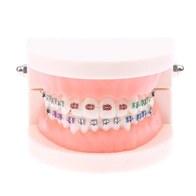 Modelo de tratamiento Dental de ortodoncia, modelo de dientes Typodont para enseñanza, estudio, soportes de Metal/cerámica, lazos de ligadura de alambre de arco, 1 unidad