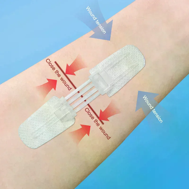 

1Pc Zipper Band-Aid - Painless Wound Closure Patch, Suture-Free Dressing for Outdoor Use (Portable)