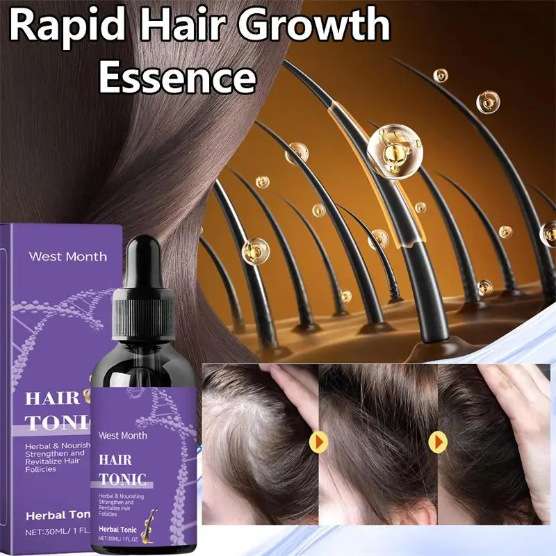 

Fast Hair Growth Oil Powerful Treatment Anti Alopecia Broken Hair Regeneration Repair Scalp Deep Nourishment Man Woman Hair Care