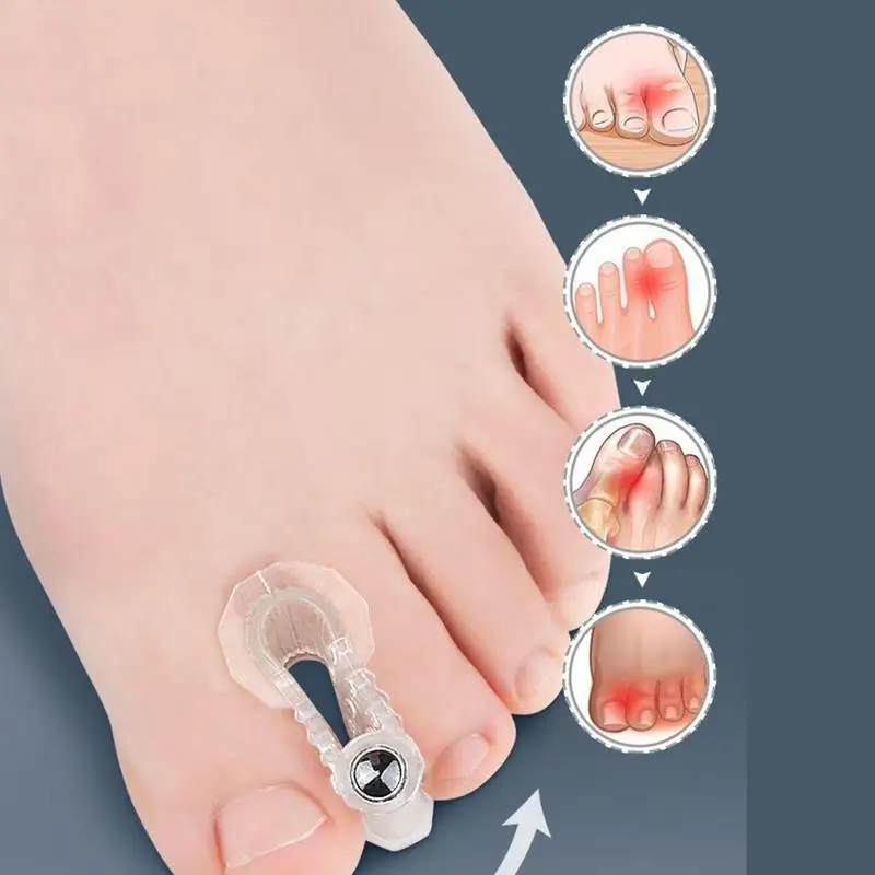 Toe Separators Magnetic Toe Splitters สำหรับผู้หญิง2Pcs ทับซ้อนกัน Corrector Toe Separators สำหรับสตรีและผู้ชาย Toes