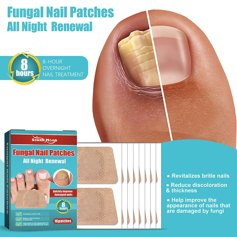 Unha Fungal Tratamento Patch, Anti Correção Fungosa Adesivos, Ingrown Toenail Care, Paroníquia Anti Infecção Reparação, 16Pcs