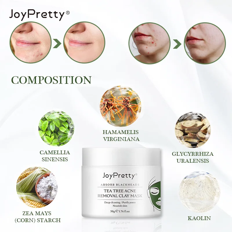 Refreshing Deep Pore Cleansing Blackhead Removal Best Clay Mask For Deep Cleansing Pore Cleansing Best Seller Revitalizing