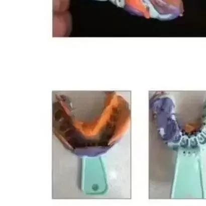 

1 комплект, лоток для зубных имплантатов, зеленый полный рот, зубные слепочные лотки, съемная частичная форма, пластиковый лоток для стоматологии, инструменты