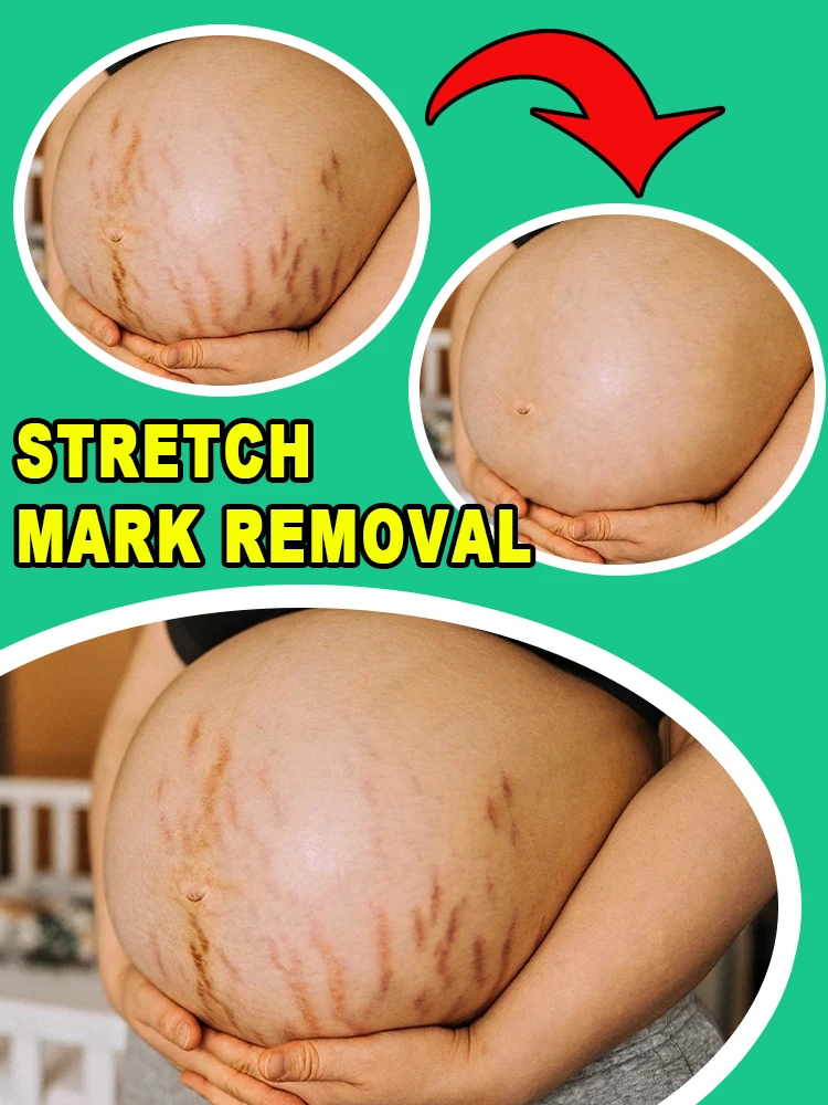 

3000+ pregnant women verified, 100% effective