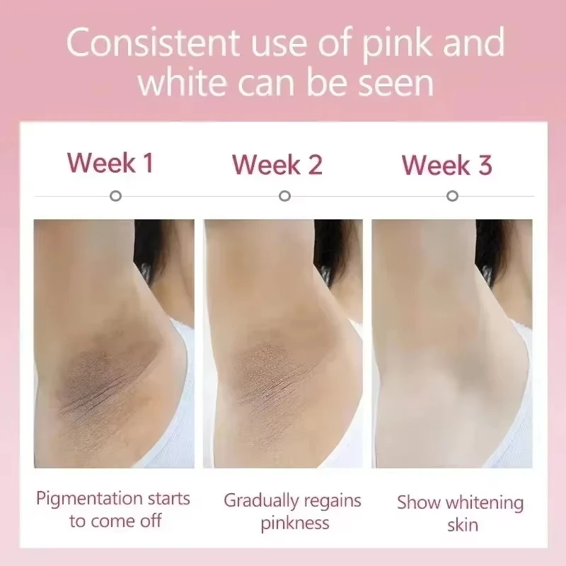 Whitening Cream Private Parts Underarm Bleaching Serum Whiten Butt Knee Brighten Inner Thigh Intimate Parts Dark Remove Melanin