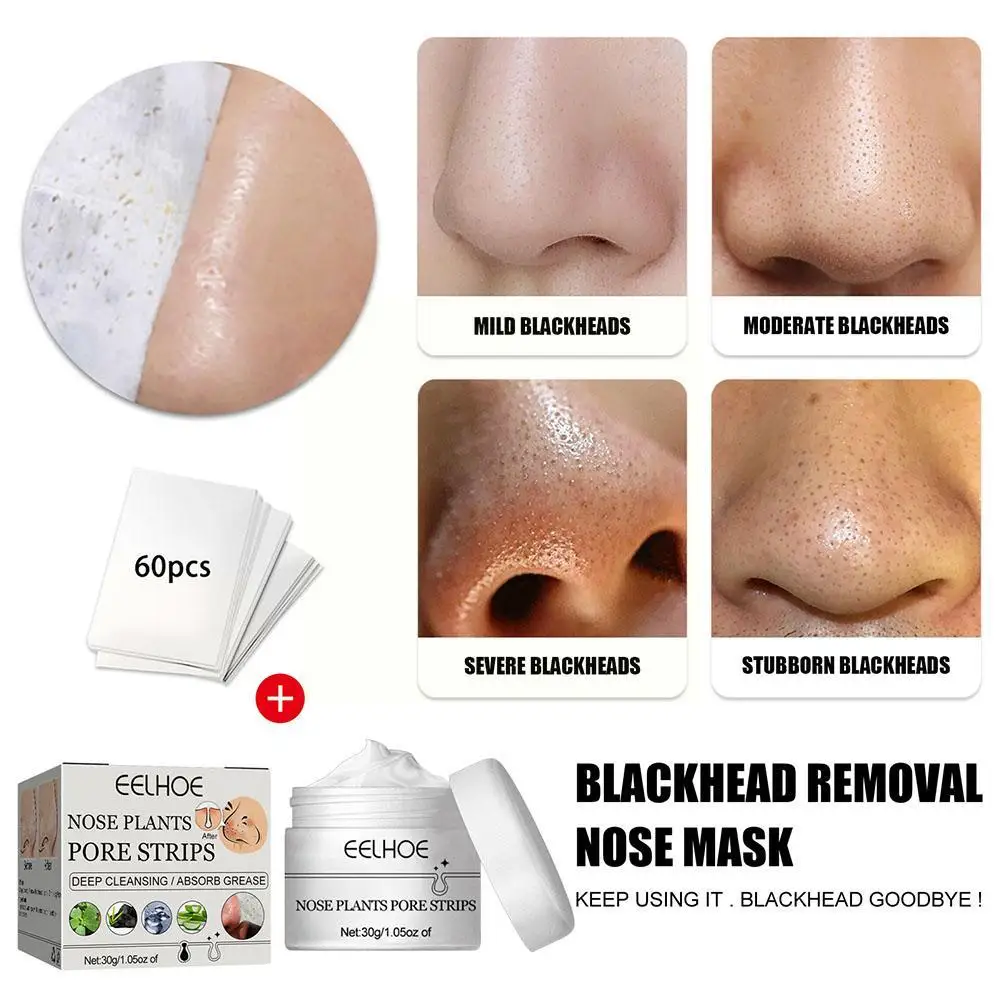 LANBENA Blackhead Remover Nose Mask Pore Strip Tearing Skin Patch Nasal Deep Black Treatment Dots Acne Care Mask Deaning Pe U0I4