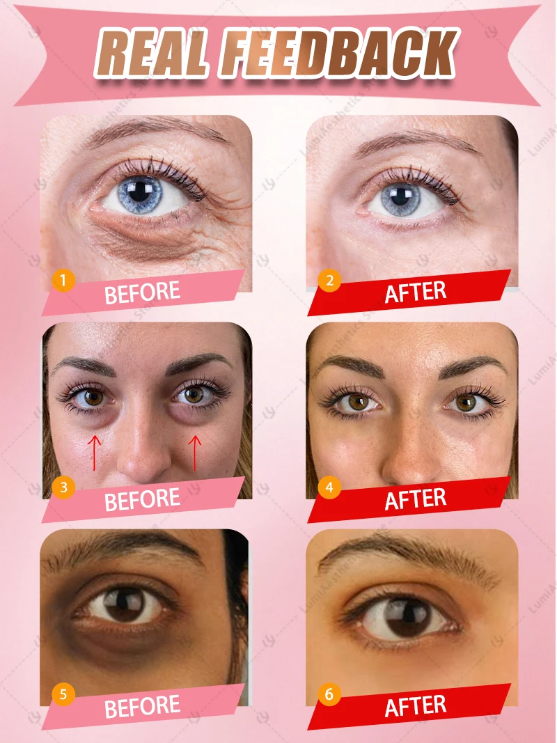 Puffy Eye Repair Cream 5