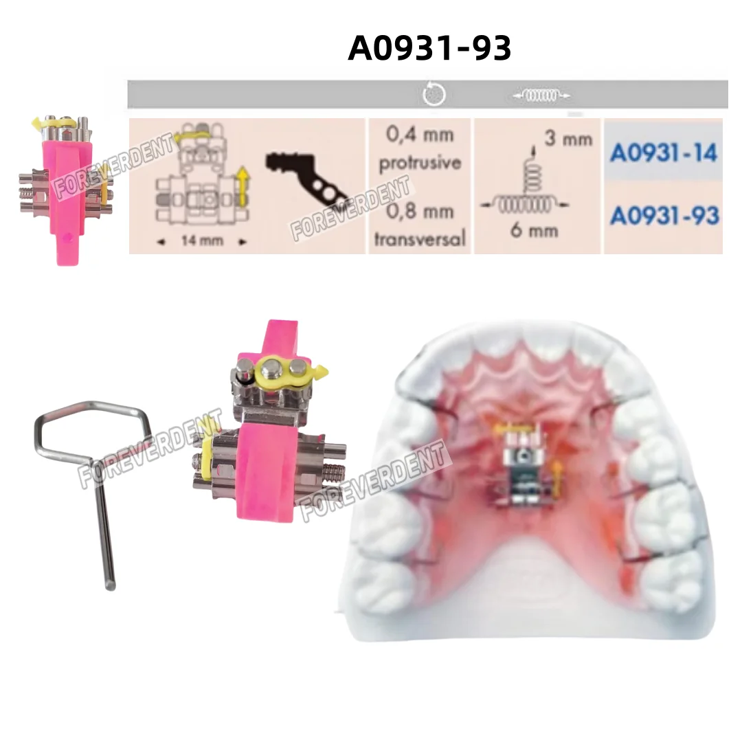 Dental Three Way Screw Expansion Screws for Upper Appliances Leone Orthodontic A0931-93