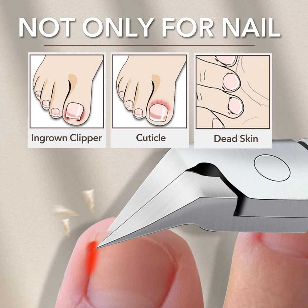 1 pz tagliaunghie per unghie dei piedi incarnite o spesse tagliaunghie dei piedi podologo professionale pinza per unghie dei piedi strumento per la cura delle unghie
