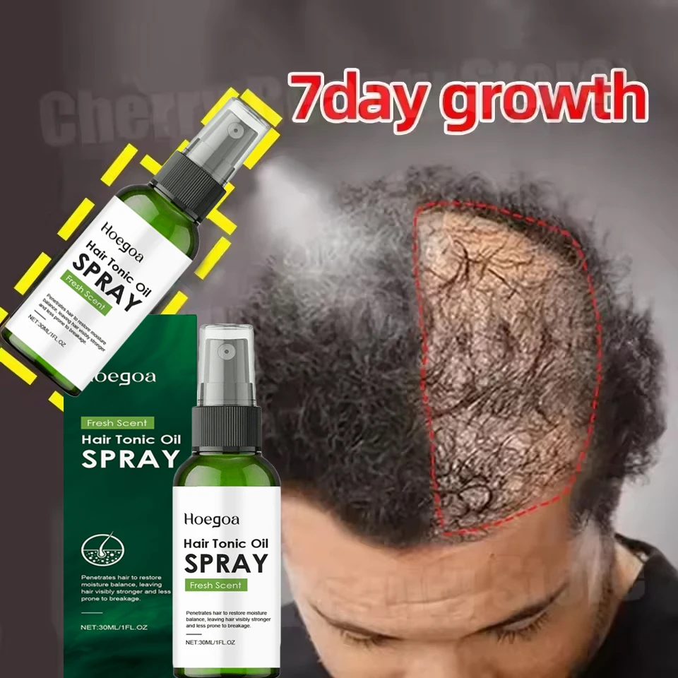 

Rosemary Fast Hair Growth Spray Anti Hair Loss Serum Prevent Baldness Treatment Scalp Beard Beauty Essence Hair Care Products