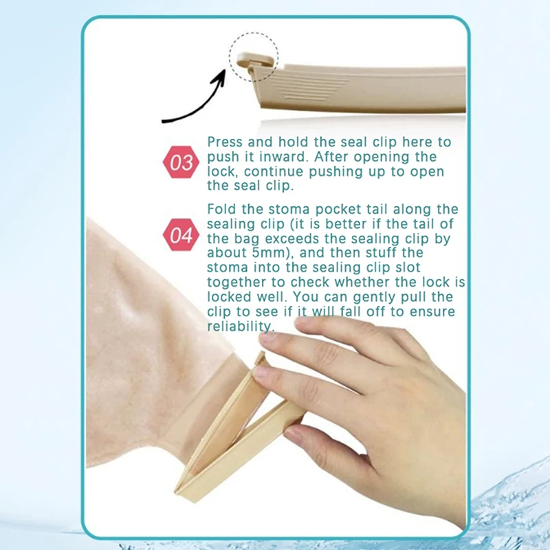 1 pz sacchetto per stomia clip di tenuta riutilizzabile flessibile sacchetto drenabile morsetto chiusura della coda strumenti per la cura postoperatoria clip per sacchetto per colostomia