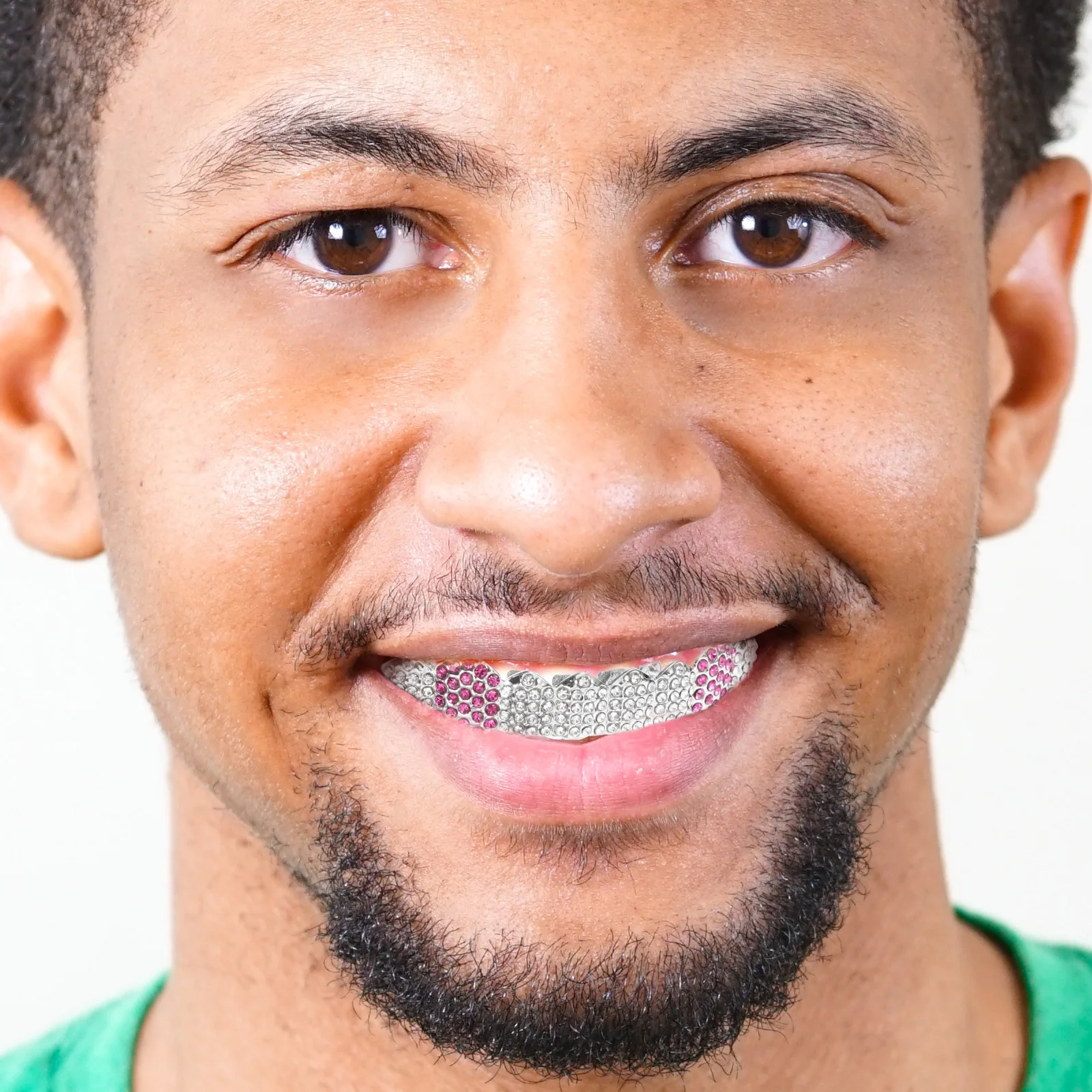 Рисунок 3 - 1 комплект, металлические брекеты