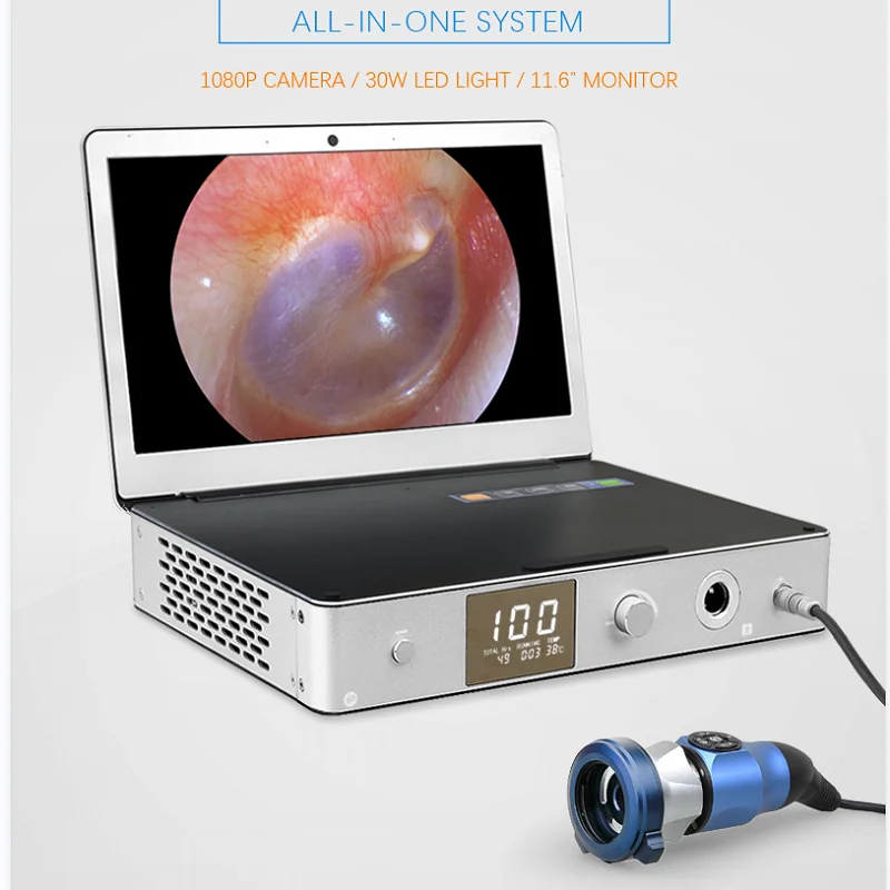 3 in 1 Portable HD 1080P Medical Endoscopy Camera with 11.6 inch Monitor