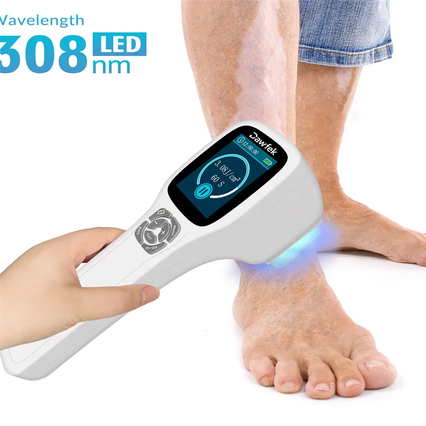 Safe 308nm UVB Light Phototherapy Uv Light And Psoriasis Blue Light Skin Care 64diodes Eliminate the Vitiligo And Dermatitis