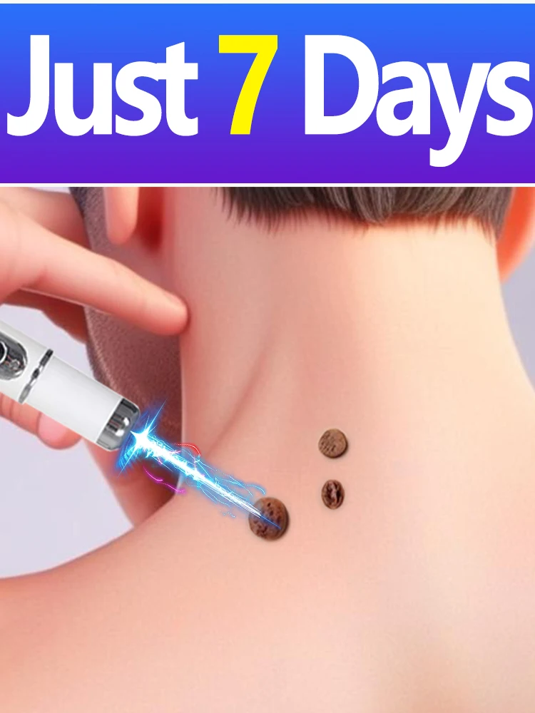 

Generation-2, бесплатная доставка по специальным предложениям для успокаивающих задач кожи, портативный комплект унисекс с синей световой ручкой