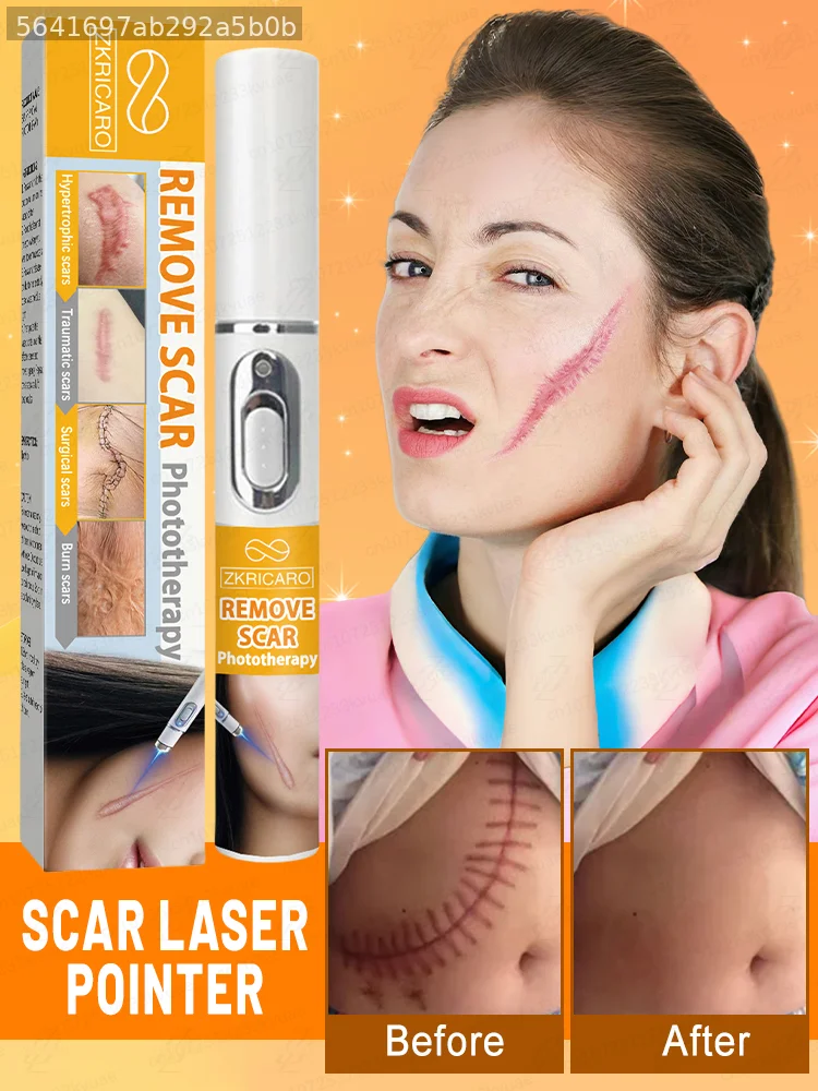 ZKRICARO Household Portable Skin Beauty Instrument Mini Hand‑held Skin Care Gadget Support Skin Surface Conditioning Optimize Overall Skin Visual Effect