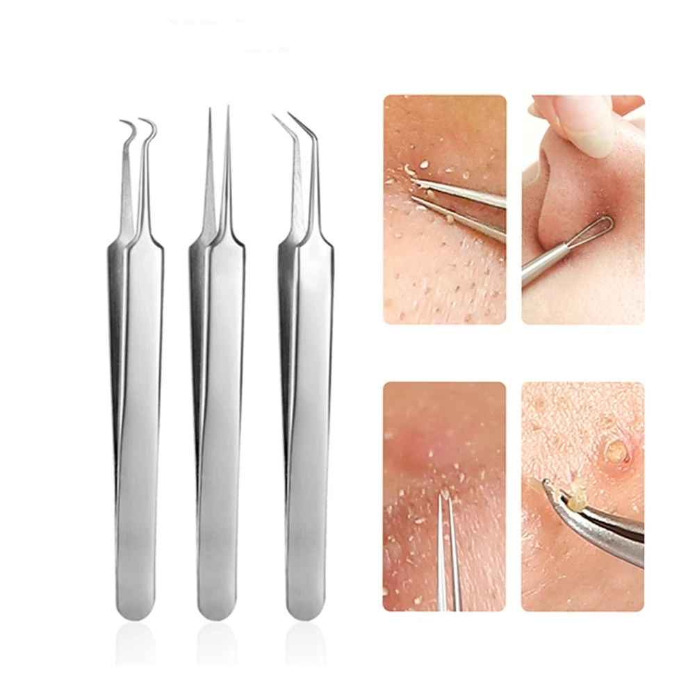 Led Acne Naald Pincet Naald Neus Puntige Punten Wenkbrauwen Pincet Voor Splinters Mee-Eter Verwijdering Acne Clip Extractor