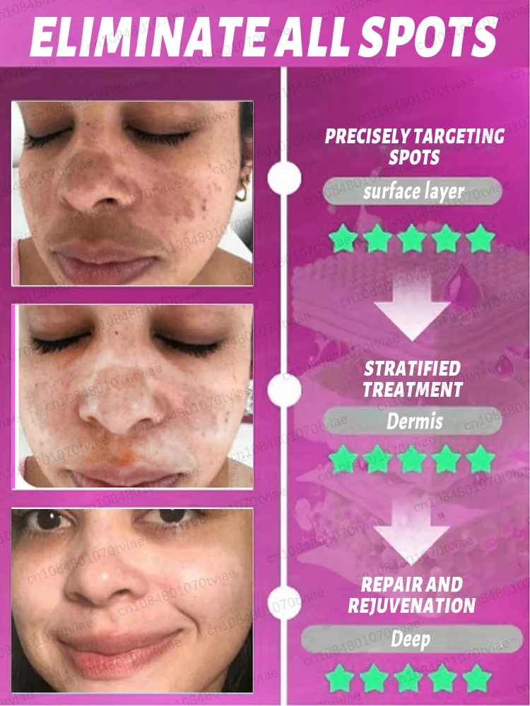 Fading spots A spot-fading product suitable for both men and women; it effectively removes brown spots, dullness, age spots, and sun spots.