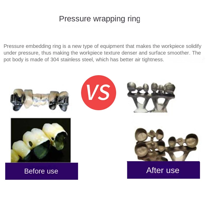 Denture processing plant pressure embedding machine laboratory casting equipment crown casting for implant implant dentistry