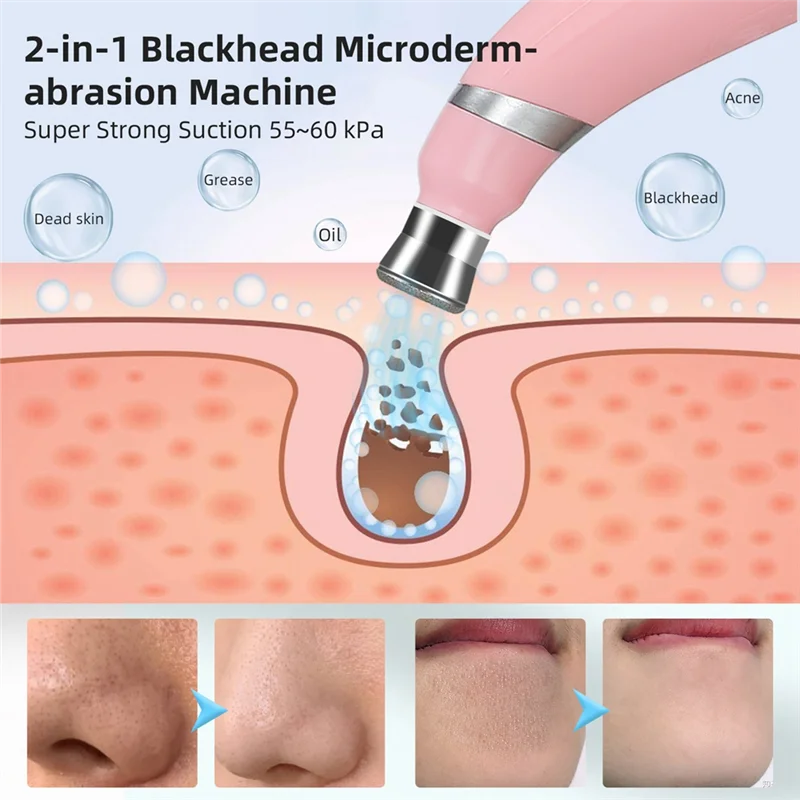 WHYY-Máquina peladora de diamantes portátil, microdermoabrasión, limpieza Facial, dispositivo de eliminación de espinillas, exfoliante de mano