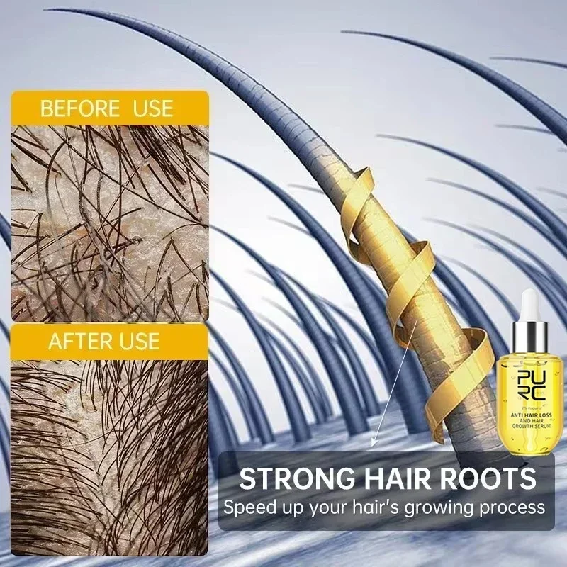 

Hairs Care Nurturing hair Reducing hair-loss and breakage Fast Hair Growth Serum Anti-Hair Loss Baldness Serum