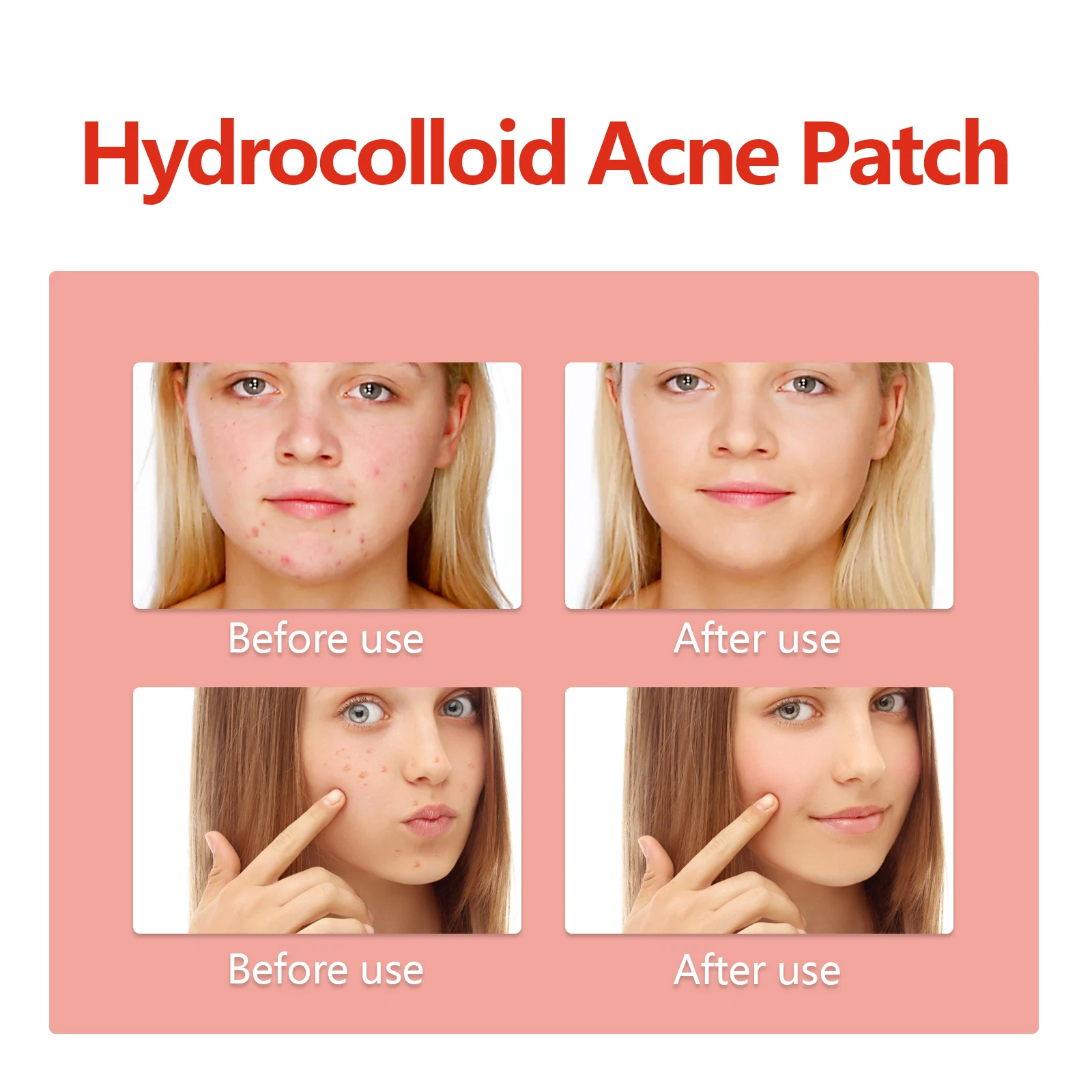 Patchs d'acné colorés, traitement hydrocolloïde doux contre les imperfections, couverture de boutons respectueuse de la peau pour peaux sensibles