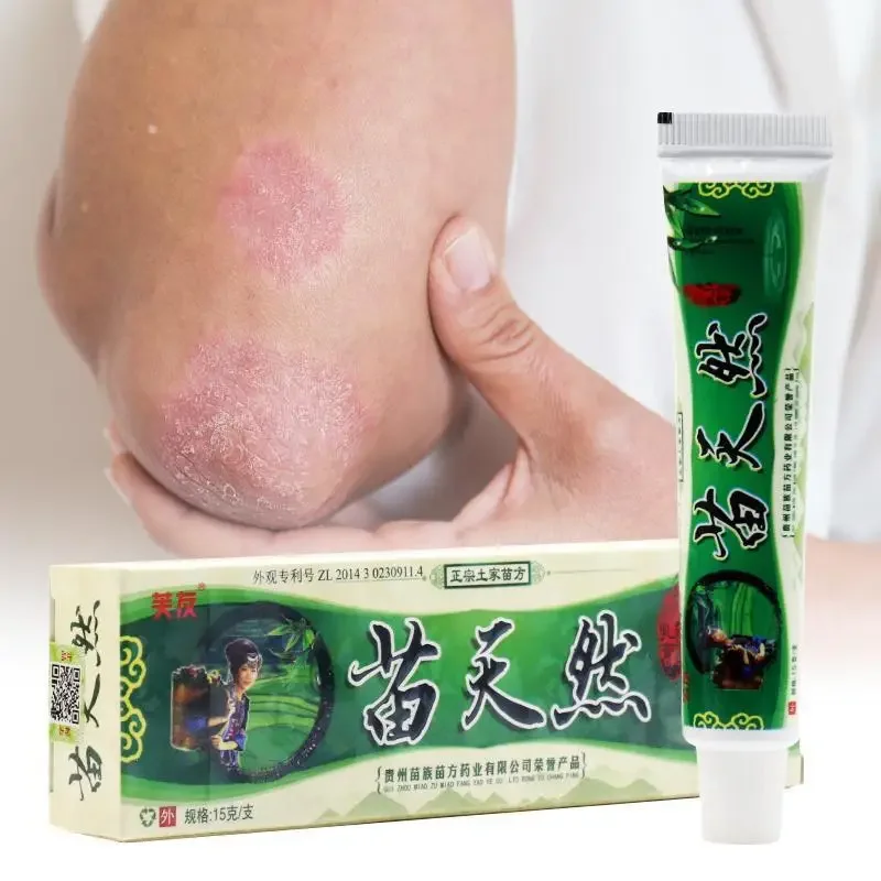 

New Miao Natural Bacteriostatic Ointment Hemorrhoids Gels Herbal Body Psoriasis Cream Plasters with Retail Box Skin Care 15g