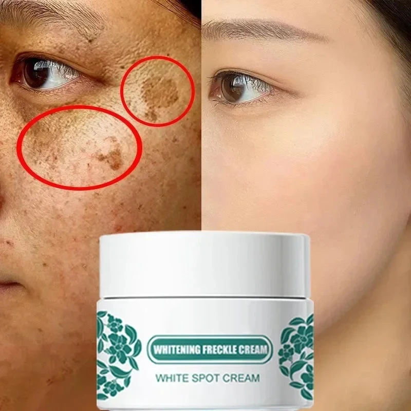 Whitening freckle removing Cream Reduces Melanin Brightens Facial Cream Lightens Dull Skin Fine Lines Facial Care Serum