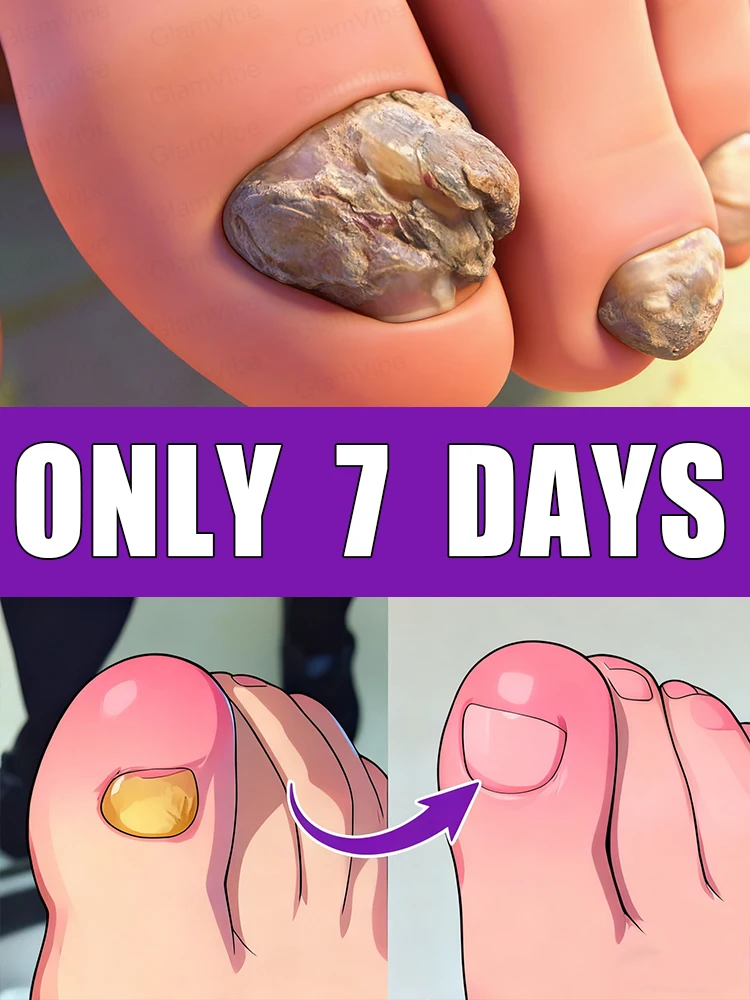 

Глубоко питает сухую, потрескавшуюся кутикулу и создает изысканную, элегантную форму ногтя.