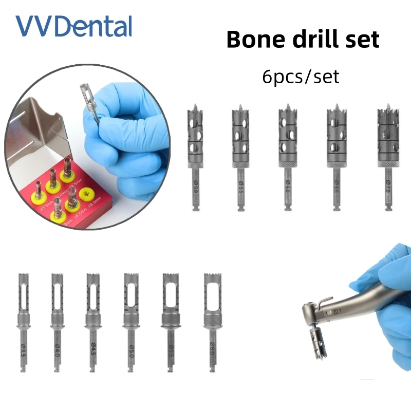 VV Dental Implant Drill Kit Trephine Bur Set for Tooth Implant Surgical Instruments Oral Surgery Tools 5pcs/Set ﻿