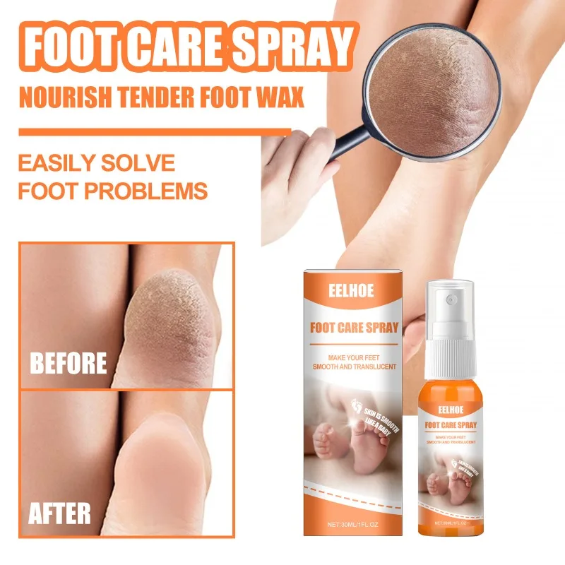 

EELHOE Foot Care Spray for Removing Dead Skin on Elbows, Knees, and Repairing Calluses on Heels.