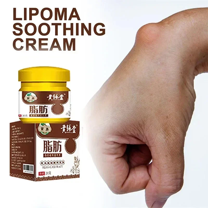 Lipoma Removal Cream บรรเทาบวมครีมกําจัดไขมันลบ Subcutaneous Lump Extract Care Fat Bulges Lump
